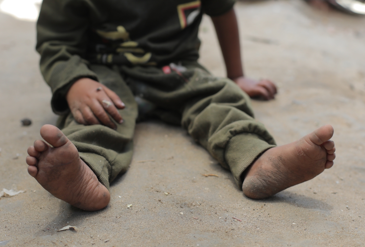 Preživjela djeca su zadobila fizičke povrede ili psihičke traume, te da djeca u Pojasu Gaze vrijeme provode među ruševinama i uskraćeno im je obrazovanje